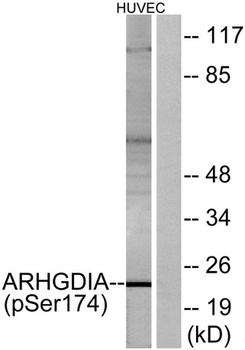 Rho GDIα (phospho Ser174) rabbit pAb