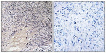 Rho GDIα rabbit pAb Antibody