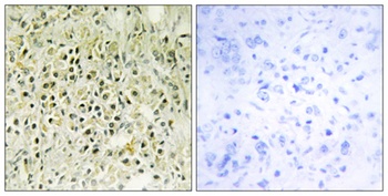 Galectin-8 rabbit pAb