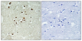 DNA Ligase IV (phospho Thr650) rabbit pAb