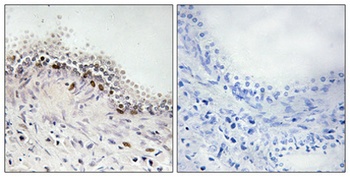 DNA Ligase IV rabbit pAb Antibody