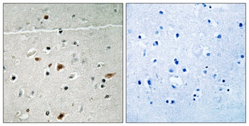 LIMK-2 (phospho Ser283) rabbit pAb