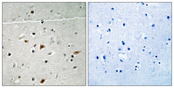 LIMK-2 (phospho-Ser283) antibody