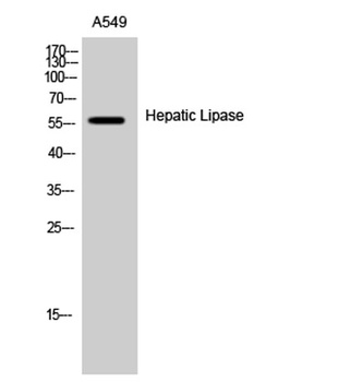 Hepatic Lipase rabbit pAb