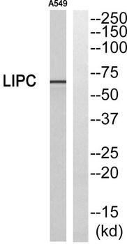 Hepatic Lipase antibody