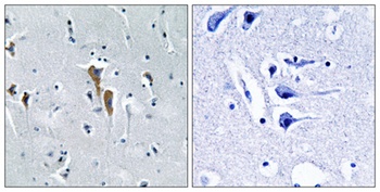Hepatic Lipase rabbit pAb
