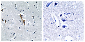 Hepatic Lipase antibody