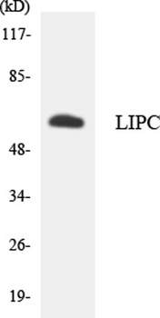 Hepatic Lipase rabbit pAb