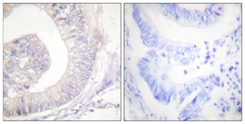 HSL (phospho Ser855) rabbit pAb