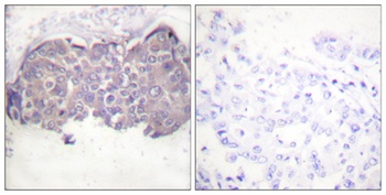 HSL (phospho Ser552) rabbit pAb