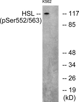 HSL (phospho-Ser552) antibody