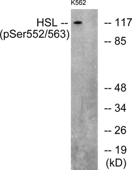 HSL (phospho Ser552) rabbit pAb