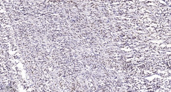 Lamin A/C (phospho Ser22) rabbit pAb