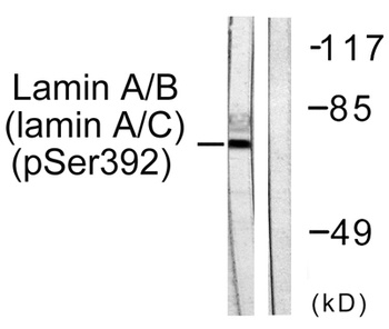 Lamin A/C (phospho Ser392) rabbit pAb