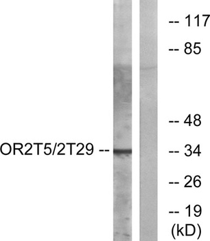 Olfactory receptor 2T5/2T29 antibody