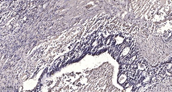 LRP3 antibody