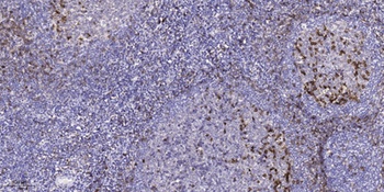 LTK antibody