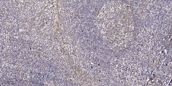 Arrestin-C antibody