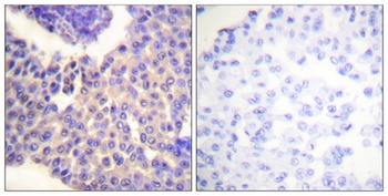 Arrestin-β-1 (phospho Ser412) rabbit pAb