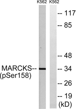 MARCKS (phospho-Ser158) antibody