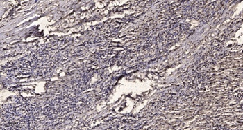 Smad2 (phospho Ser465) rabbit pAb