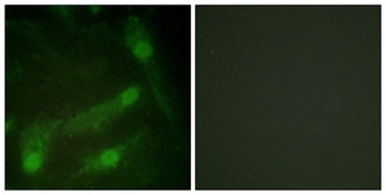 Smad2 (phospho Thr220) rabbit pAb