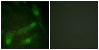 Smad2 (phospho-Thr220) antibody