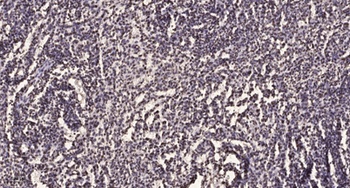 Smad3 (phospho-Ser213) antibody