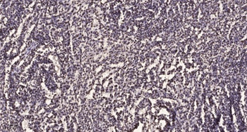 Smad3 (phospho Ser213) rabbit pAb