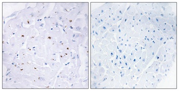 Smad3 (phospho Thr179) rabbit pAb