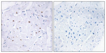 Smad3 (phospho-Thr179) antibody