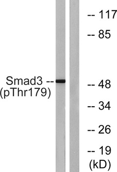Smad3 (phospho Thr179) rabbit pAb