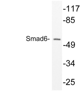 Smad6 antibody