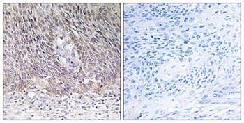 Arylsulfatase A rabbit pAb Antibody