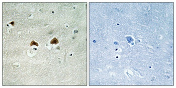 MAP-4 (phospho Ser696) rabbit pAb
