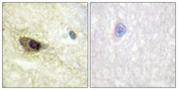MAP-4 (phospho Ser696) rabbit pAb