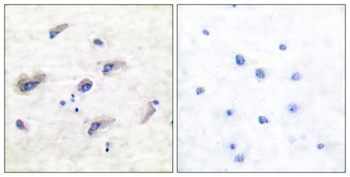 Tau (phospho-Ser356) antibody