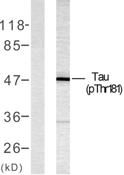 Tau (phospho-Thr181) antibody