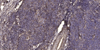 Tau (phospho Thr534) rabbit pAb