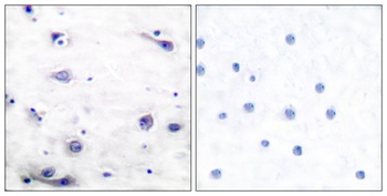 Tau (phospho Ser422) rabbit pAb