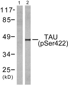 Tau (phospho-Ser422) antibody