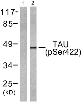 Tau (phospho Ser422) rabbit pAb