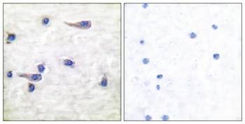 Tau (phospho Thr212) rabbit pAb