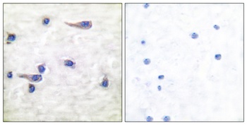 Tau (phospho-Thr212) antibody