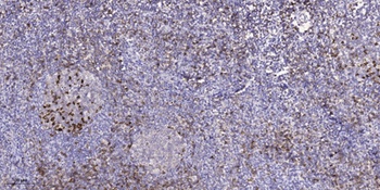 MARK1/2/3/4 (phospho Thr215) rabbit pAb