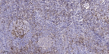 MARK1/2/3/4 (phospho-Thr215) antibody