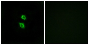 Arylsulfatase D rabbit pAb Antibody