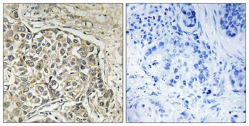 Arylsulfatase D antibody