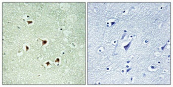 Max (phospho Ser2) rabbit pAb