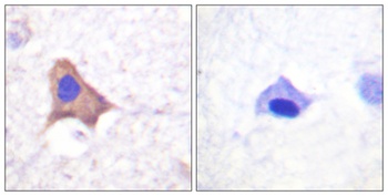 CD71 (phospho-Ser24) antibody